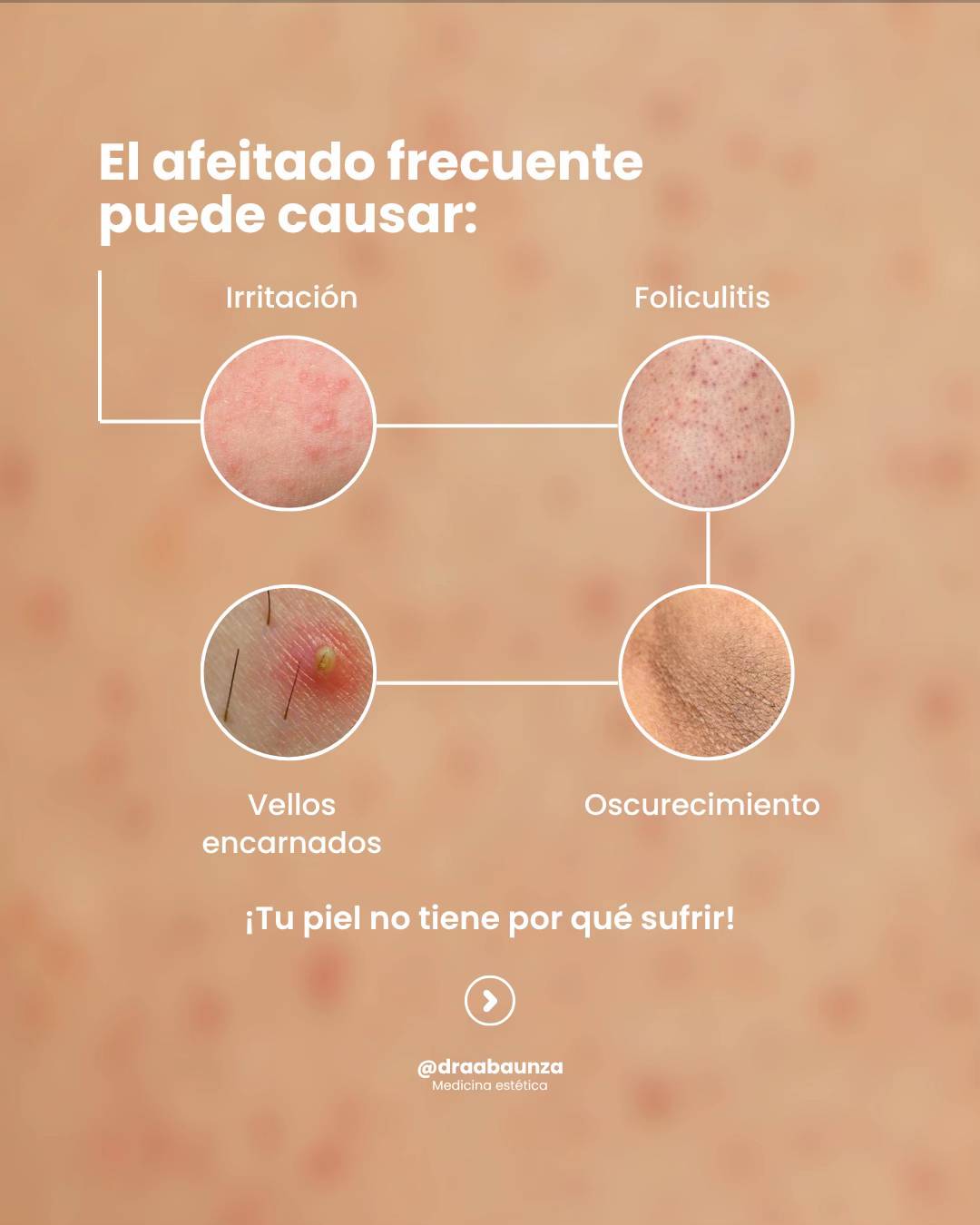 Aceite Post‑Afeitado Corporal Truly Morazul